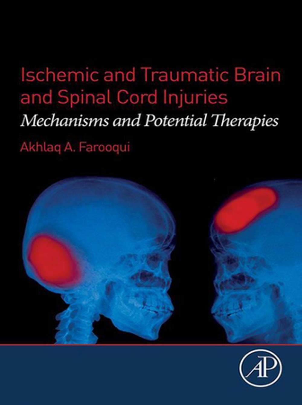 Big bigCover of Ischemic and Traumatic Brain and Spinal Cord Injuries