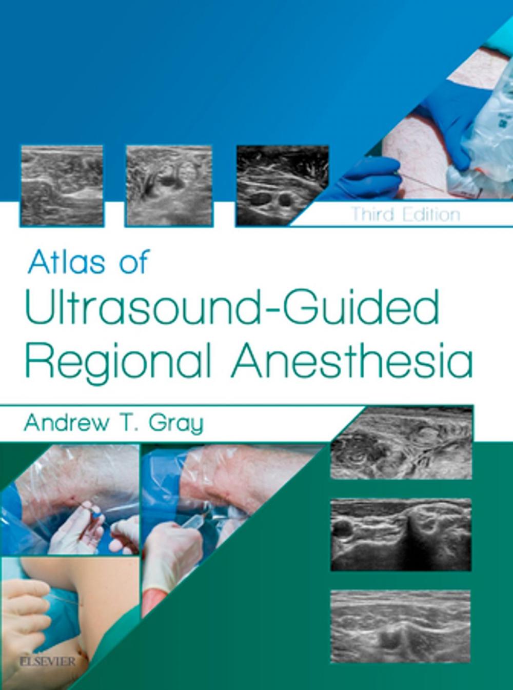 Big bigCover of Atlas of Ultrasound-Guided Regional Anesthesia E-Book