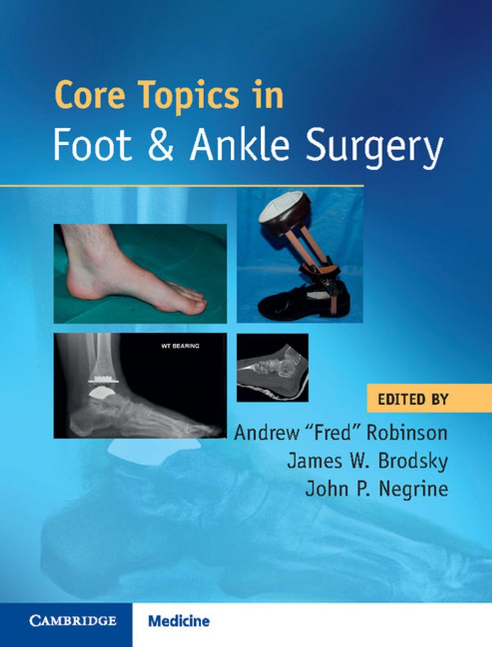 Big bigCover of Core Topics in Foot and Ankle Surgery