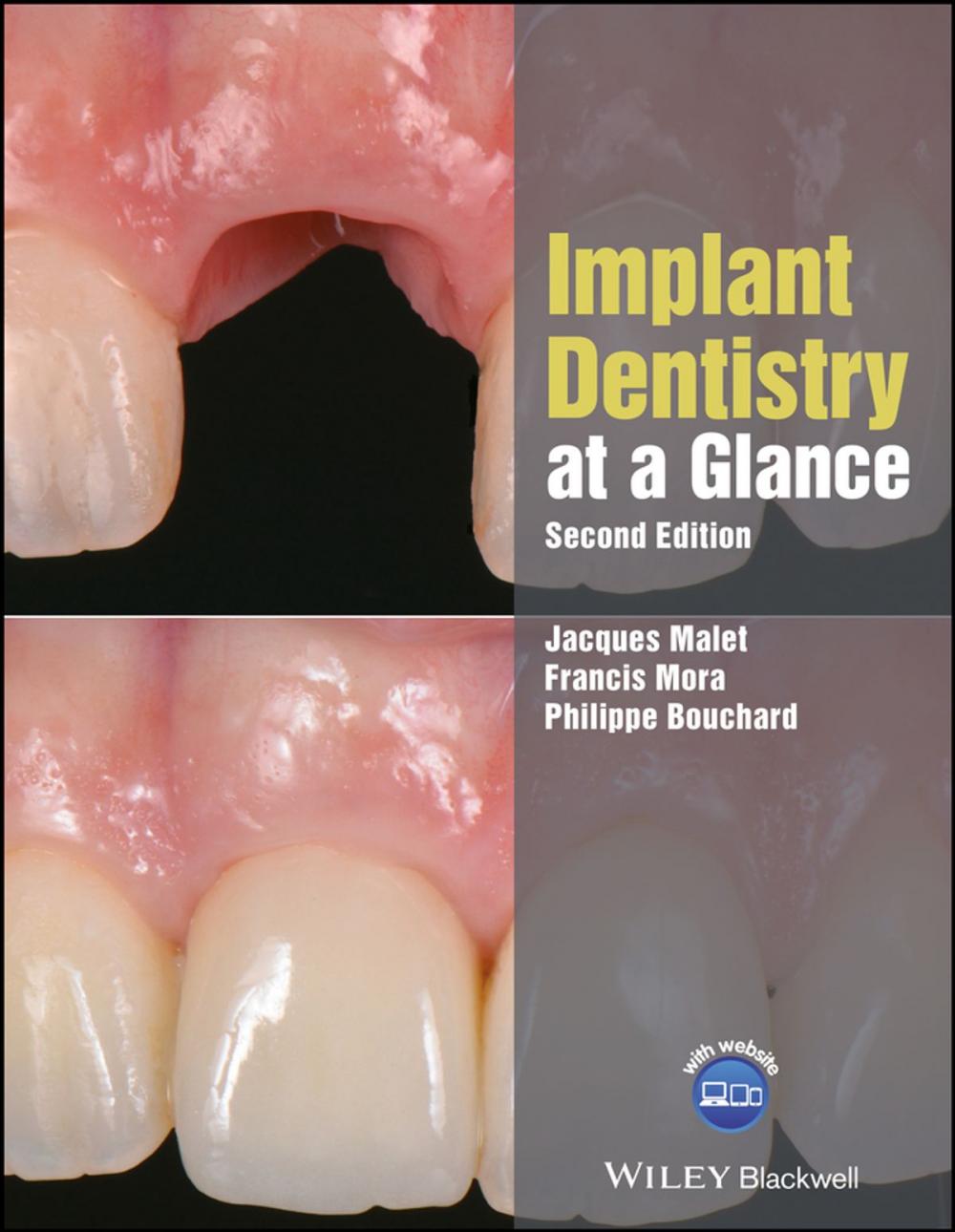 Big bigCover of Implant Dentistry at a Glance