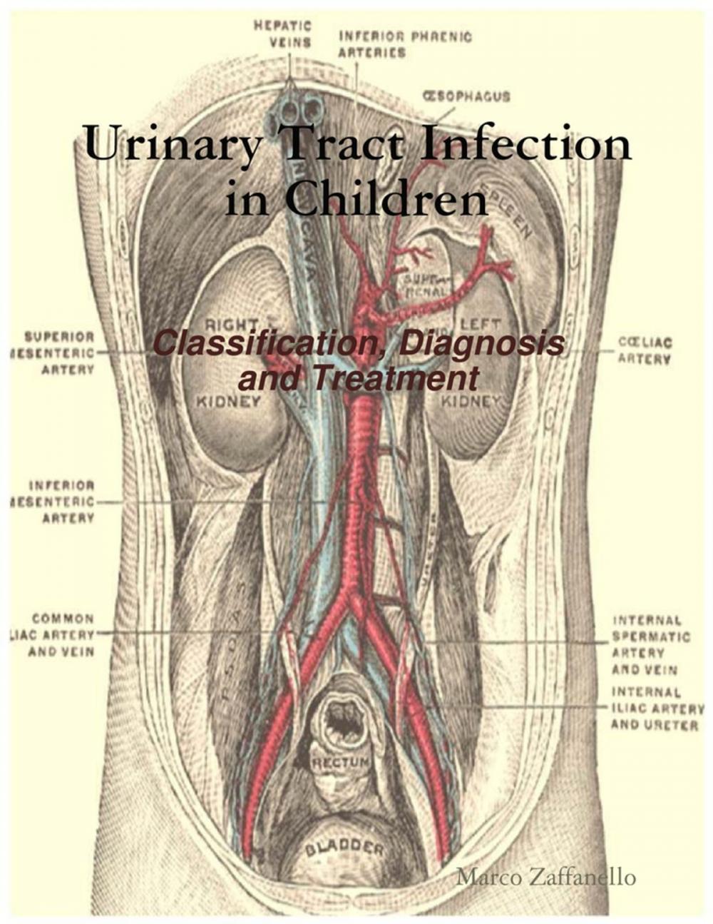 Big bigCover of Urinary Tract Infection in Children - Classification, Diagnosis and Treatment