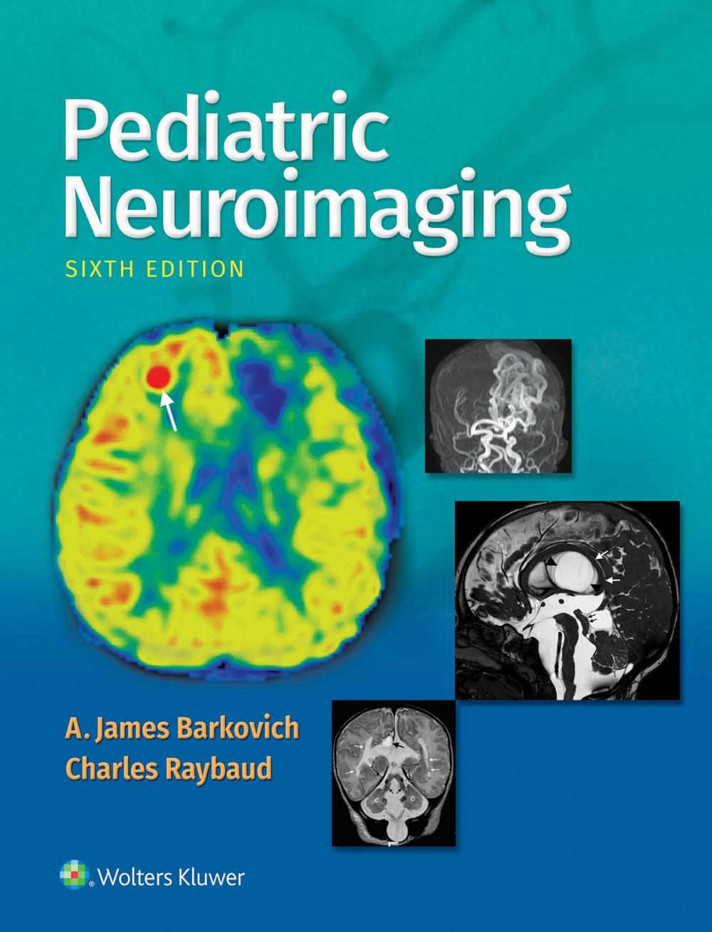 Big bigCover of Pediatric Neuroimaging