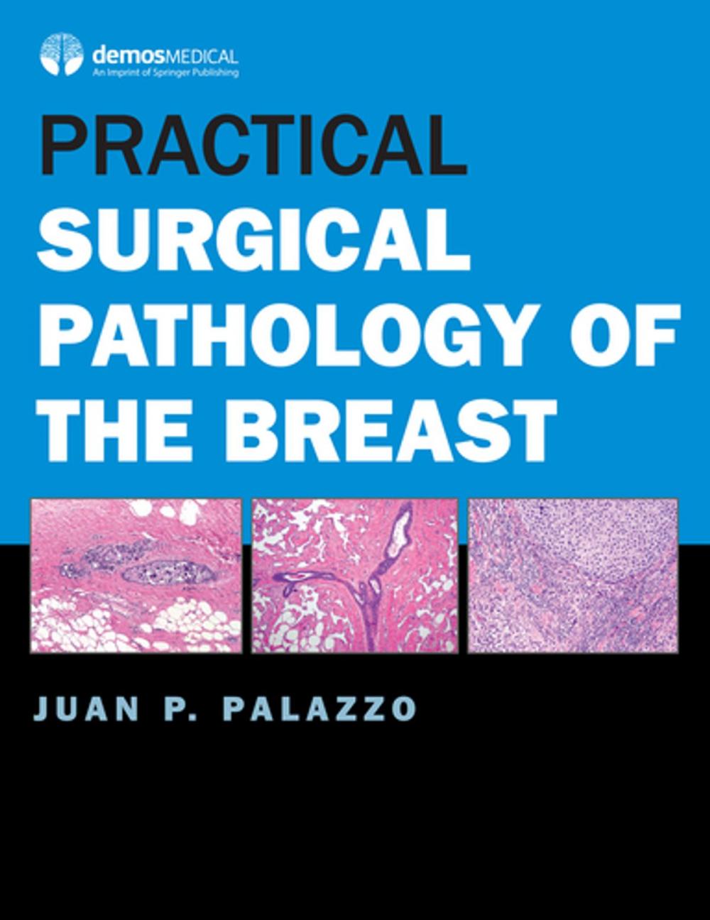 Big bigCover of Practical Surgical Pathology of the Breast