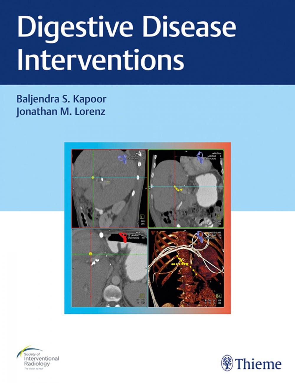 Big bigCover of Digestive Disease Interventions