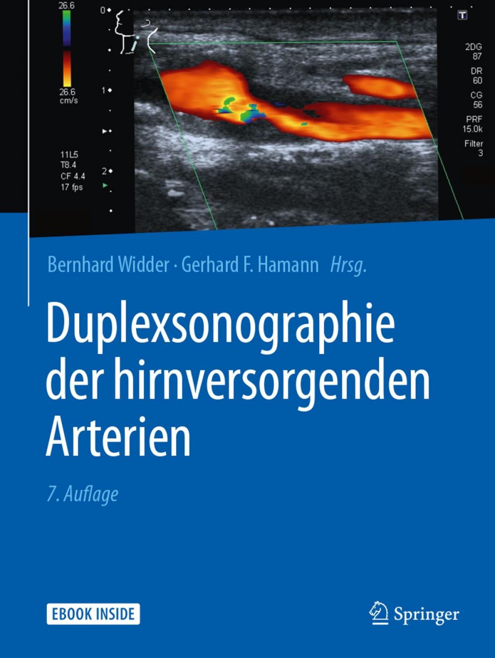 Big bigCover of Duplexsonographie der hirnversorgenden Arterien