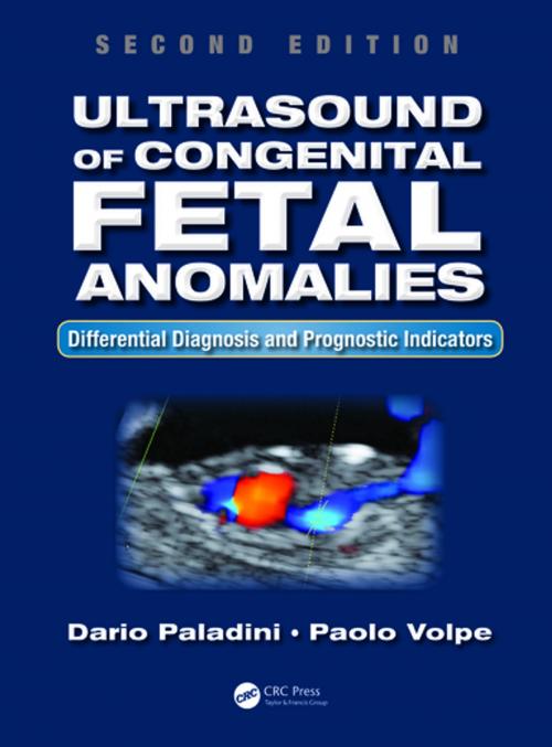 Cover of the book Ultrasound of Congenital Fetal Anomalies by Dario Paladini, Paolo Volpe, CRC Press