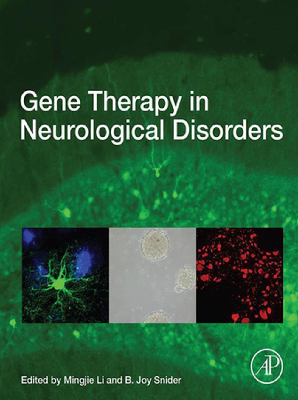 Big bigCover of Gene Therapy in Neurological Disorders