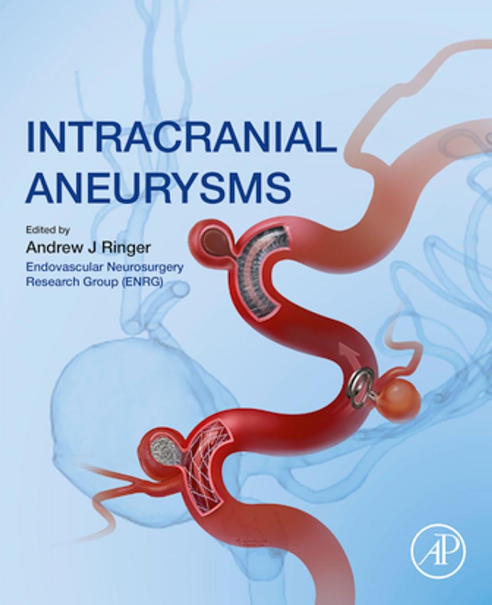 Big bigCover of Intracranial Aneurysms