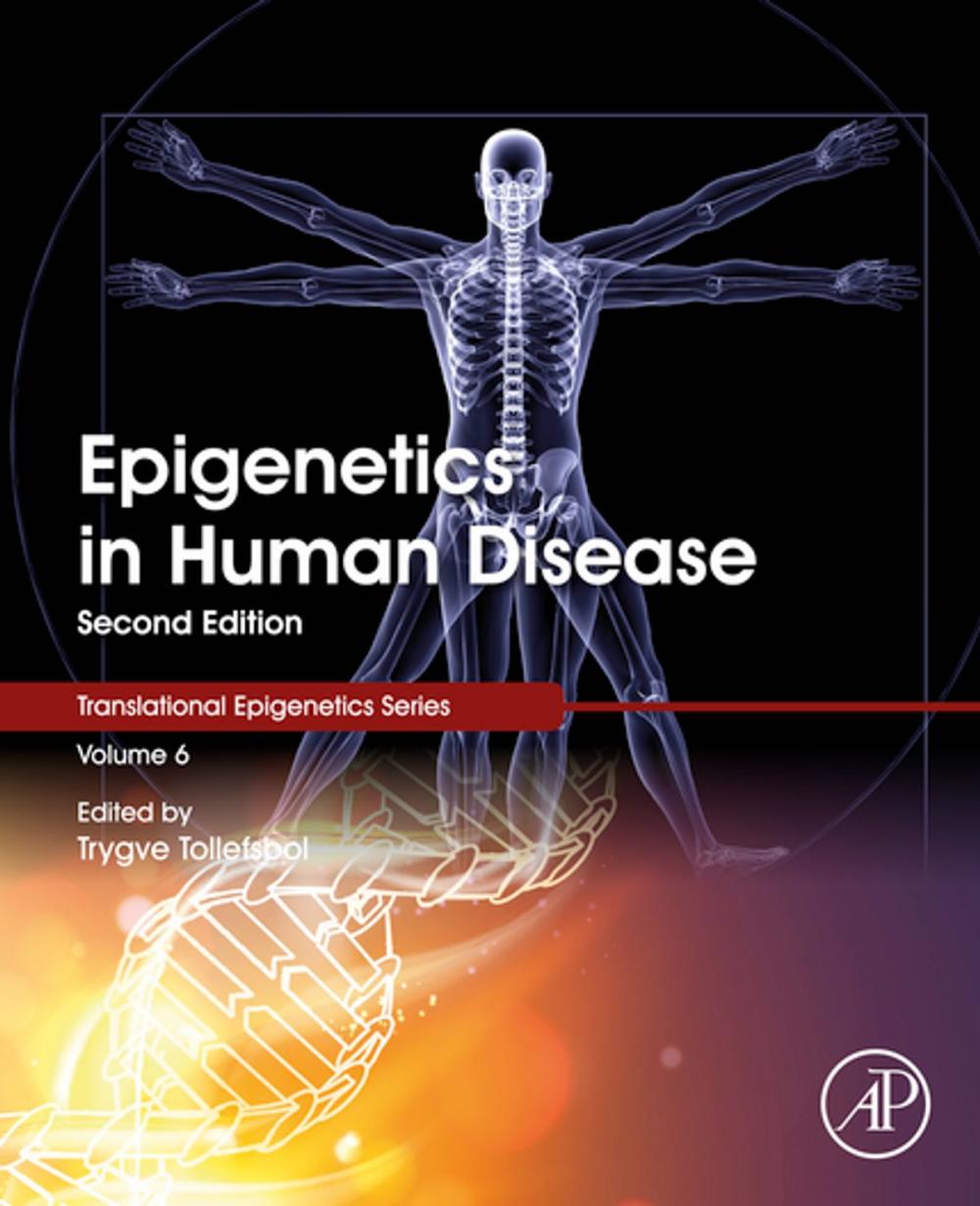 Big bigCover of Epigenetics in Human Disease