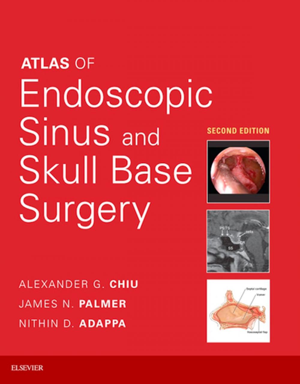 Big bigCover of Atlas of Endoscopic Sinus and Skull Base Surgery E-Book