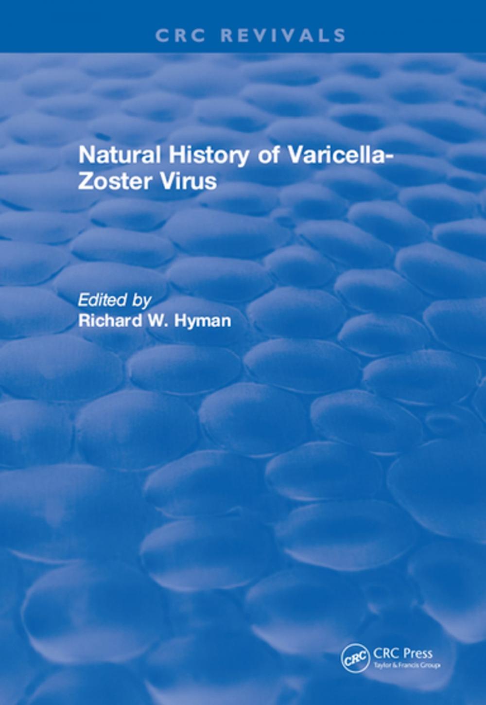 Big bigCover of Natural History of Varicella-Zoster Virus