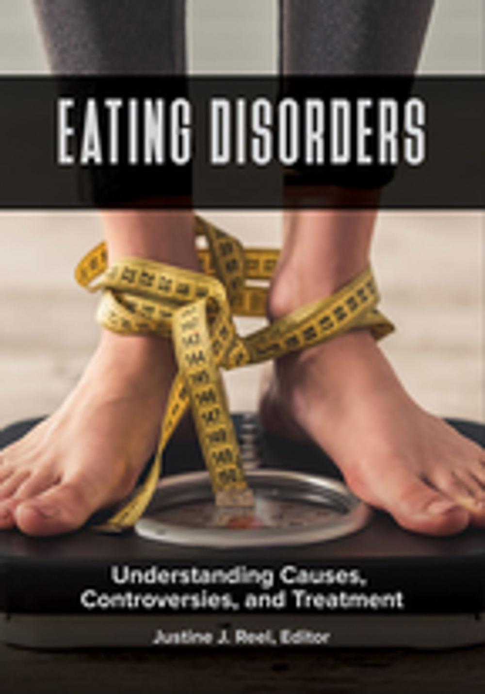 Big bigCover of Eating Disorders: Understanding Causes, Controversies, and Treatment [2 volumes]