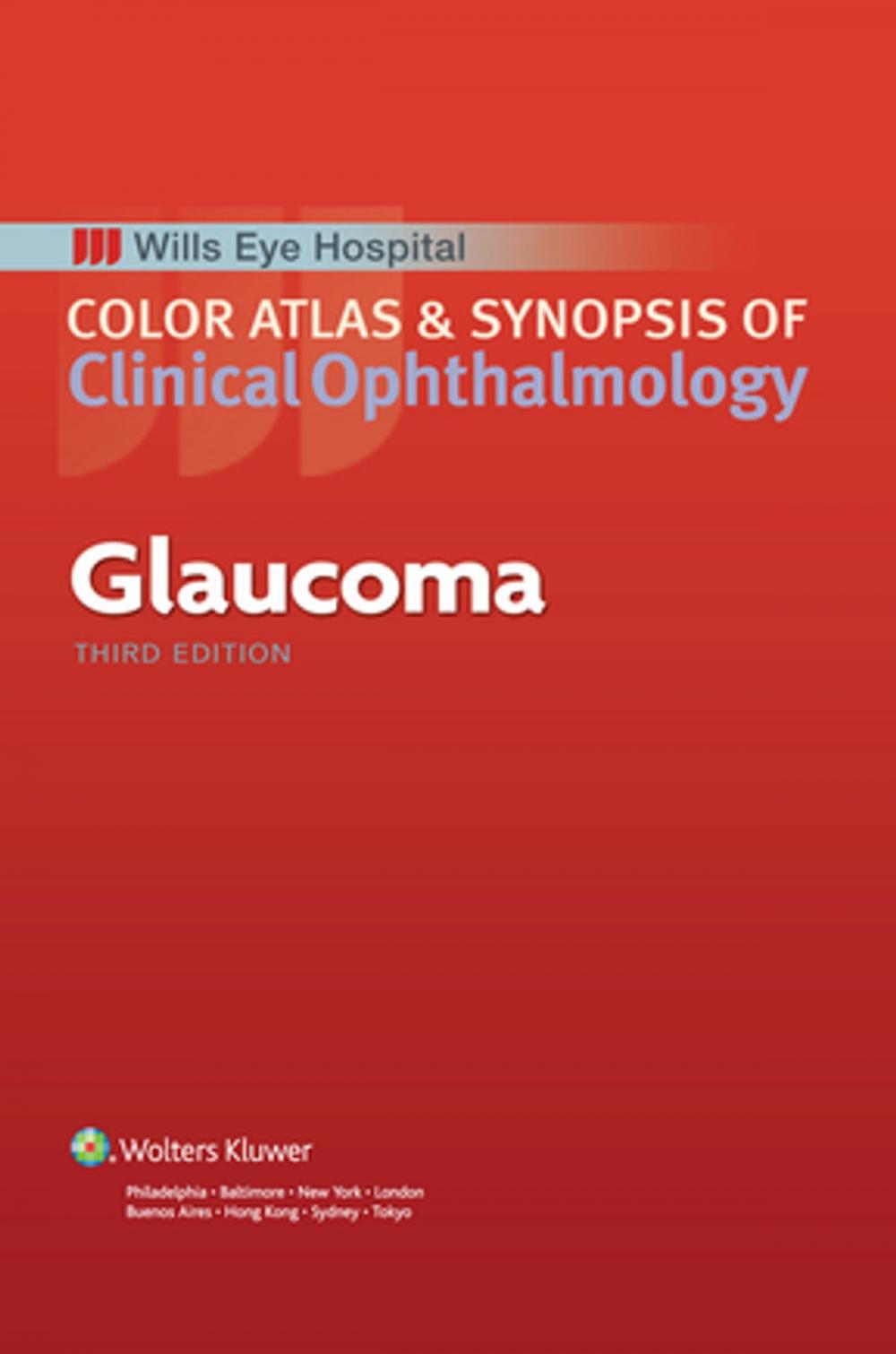 Big bigCover of Glaucoma