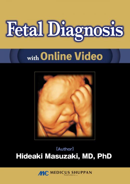 Cover of the book Fetal Diagnosis with Online Video by Hideaki Masuzaki, MEDICUS SHUPPAN, Publishers Co., Ltd