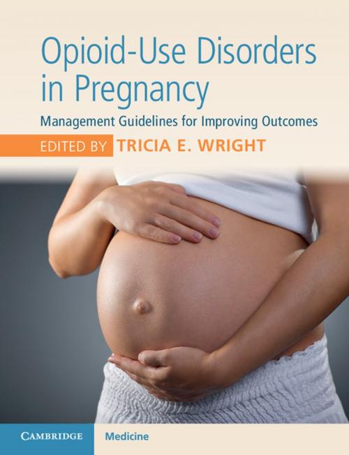 Cover of the book Opioid-Use Disorders in Pregnancy by , Cambridge University Press