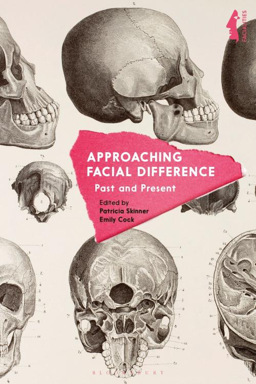 Cover of the book Approaching Facial Difference by , Bloomsbury Publishing