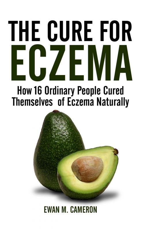Cover of the book The Cure For Eczema by Ewan M Cameron, Inspired Publishing