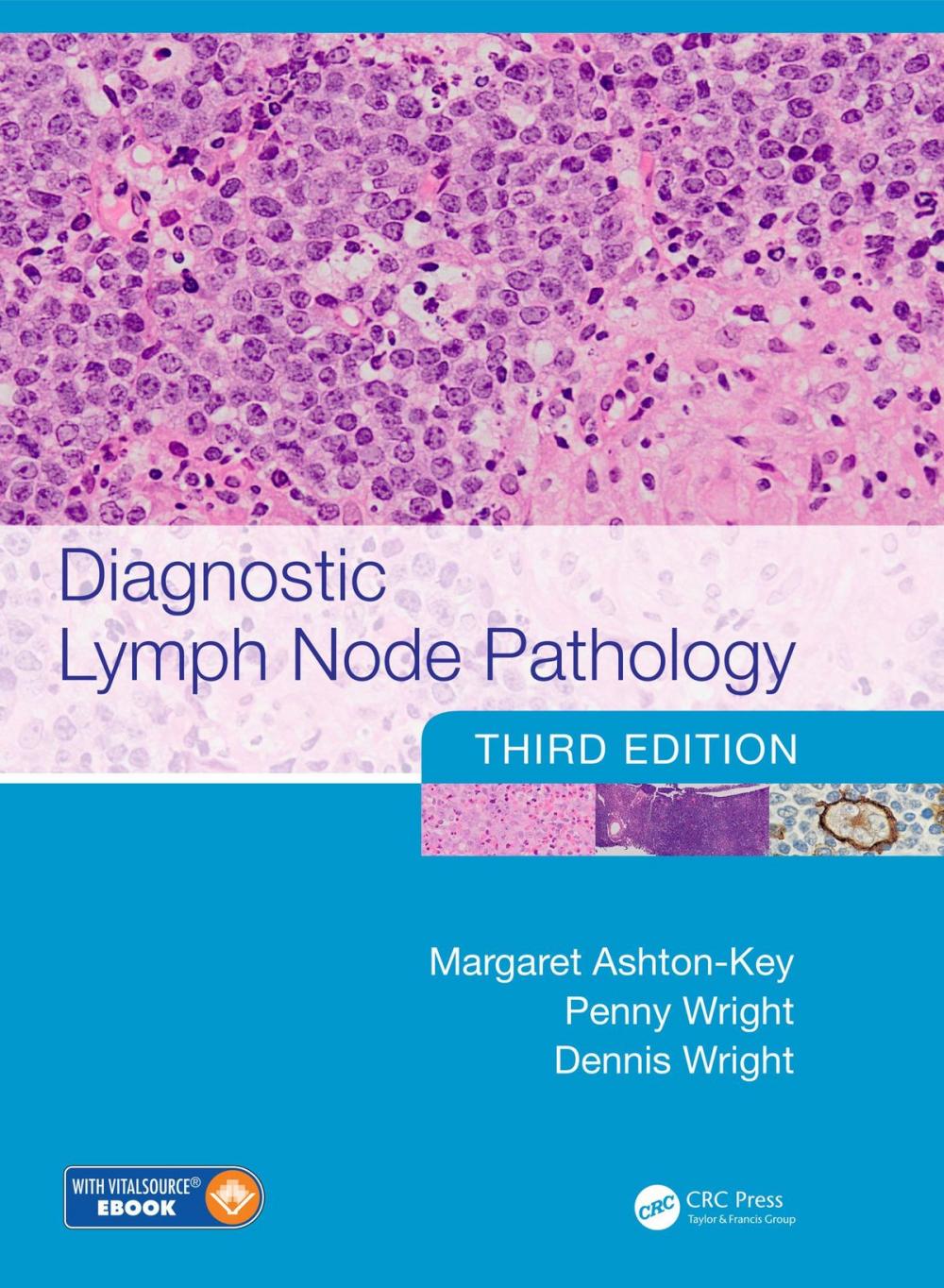 Big bigCover of Diagnostic Lymph Node Pathology