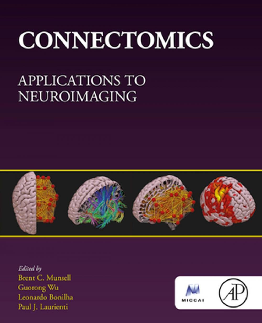 Big bigCover of Connectomics