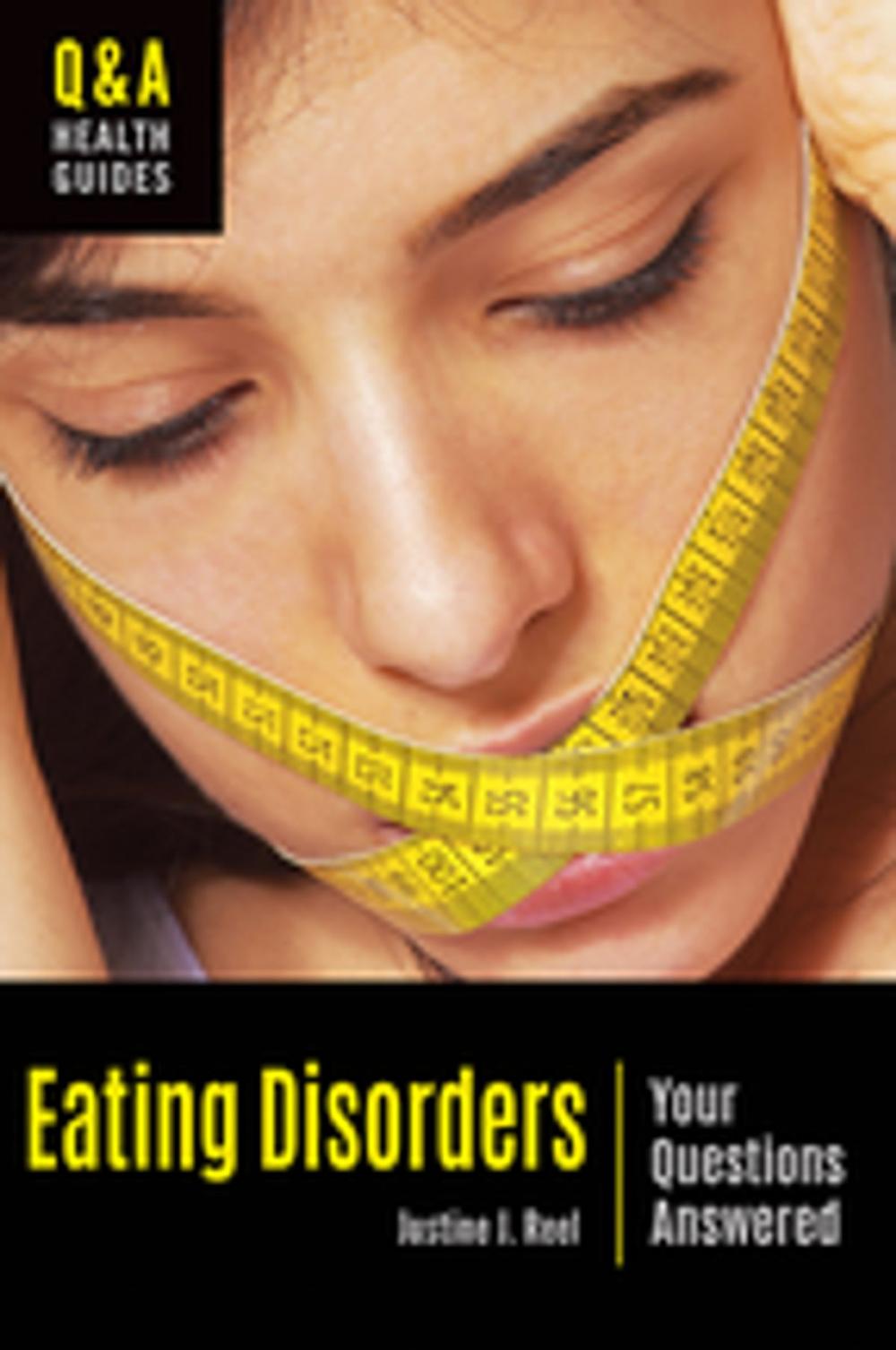 Big bigCover of Eating Disorders: Your Questions Answered