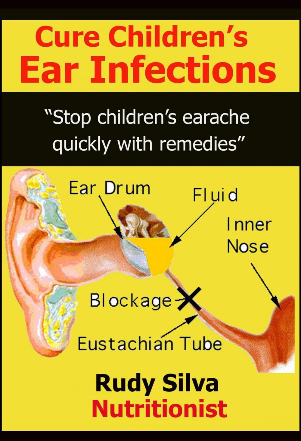 Big bigCover of Cure Children’s Ear Infections