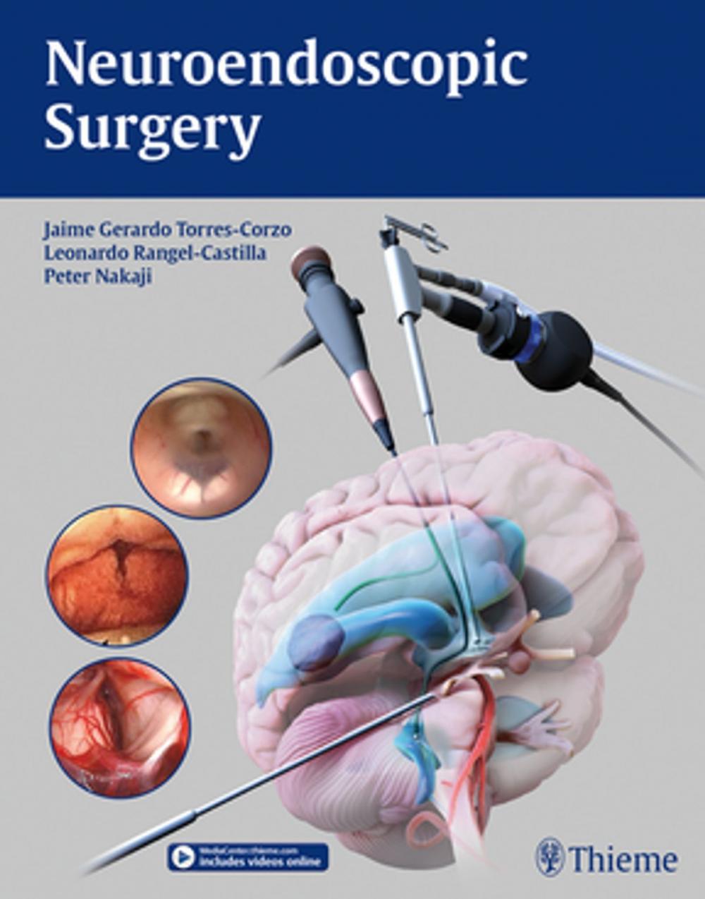 Big bigCover of Neuroendoscopic Surgery