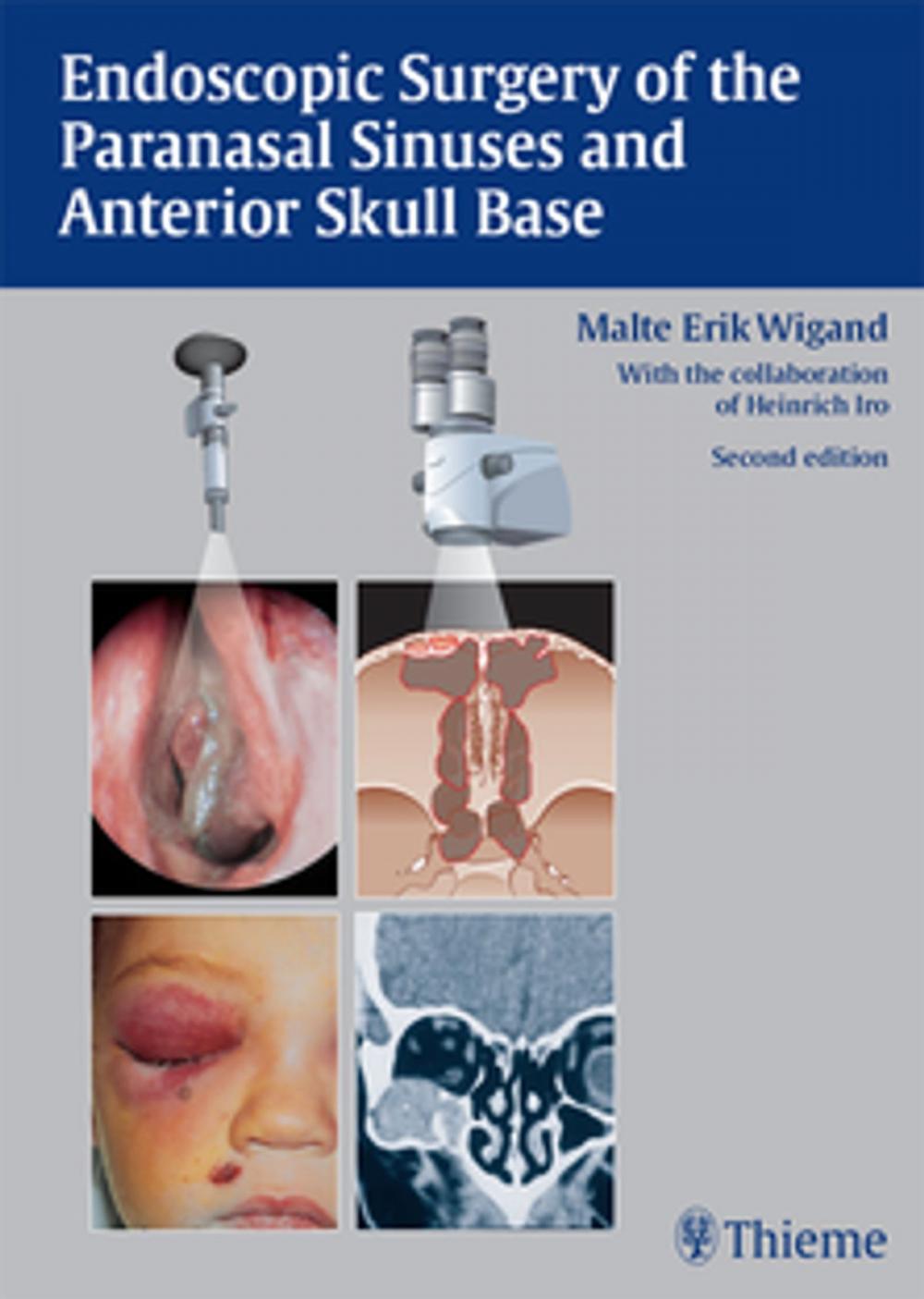 Big bigCover of Endoscopic Surgery of the Paranasal Sinuses and Anterior Skull Base