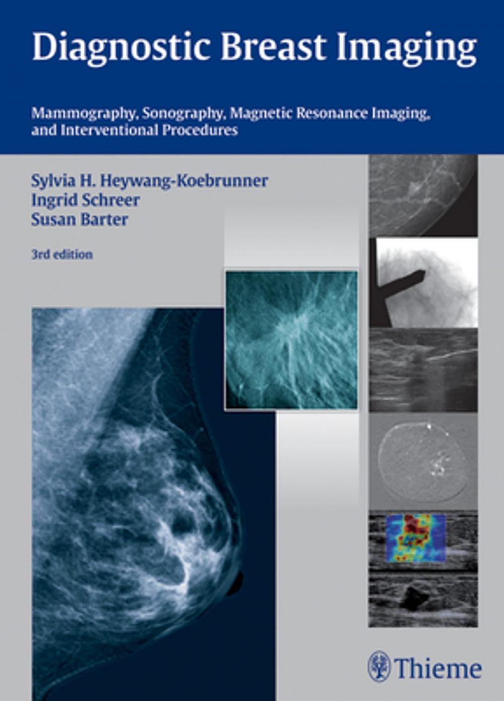 Big bigCover of Diagnostic Breast Imaging