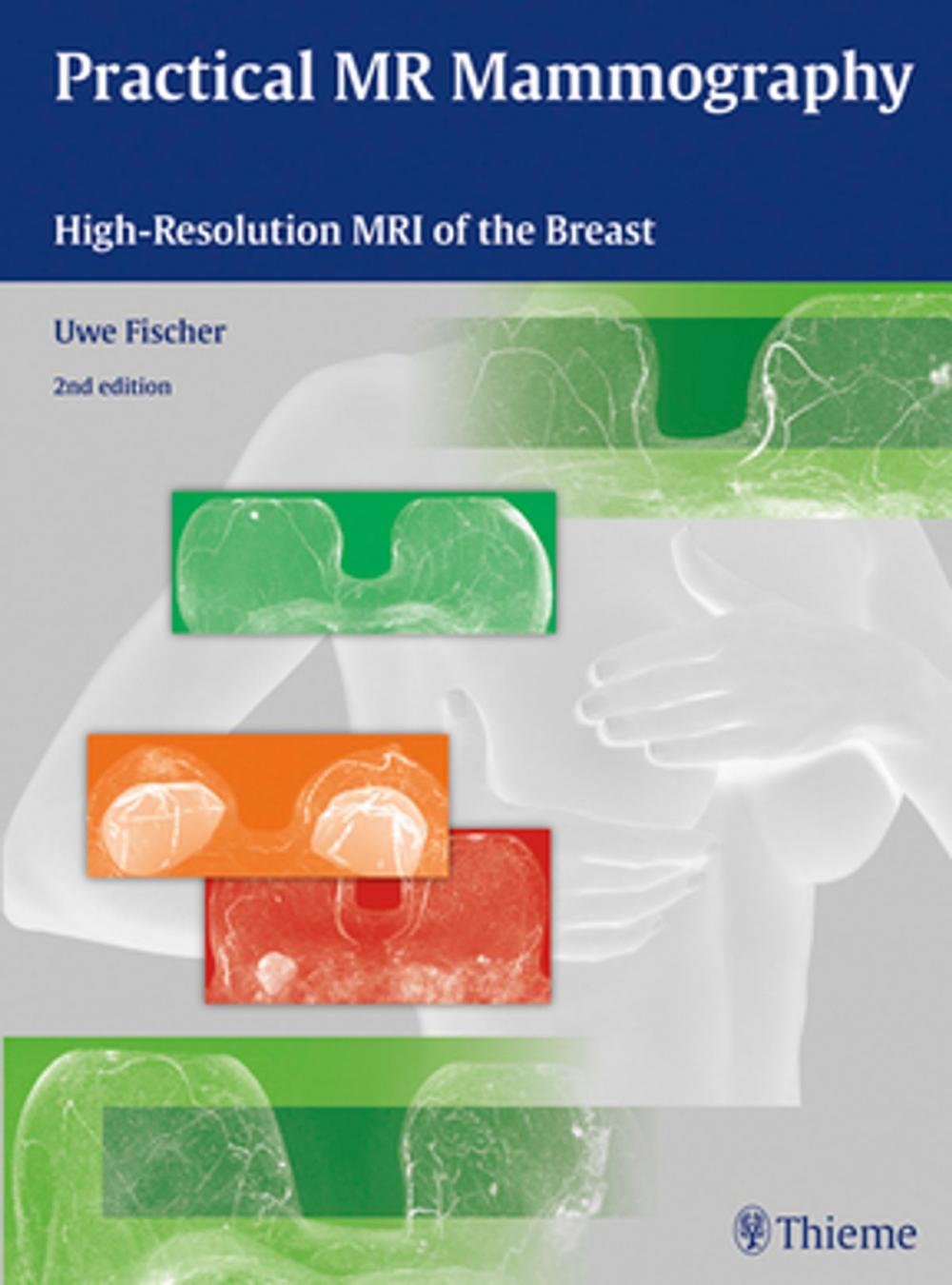 Big bigCover of Practical MR Mammography