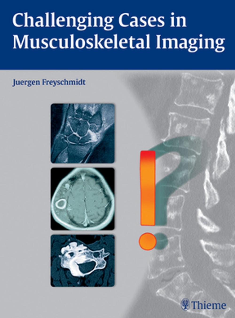 Big bigCover of Challenging Cases in Musculoskeletal Imaging