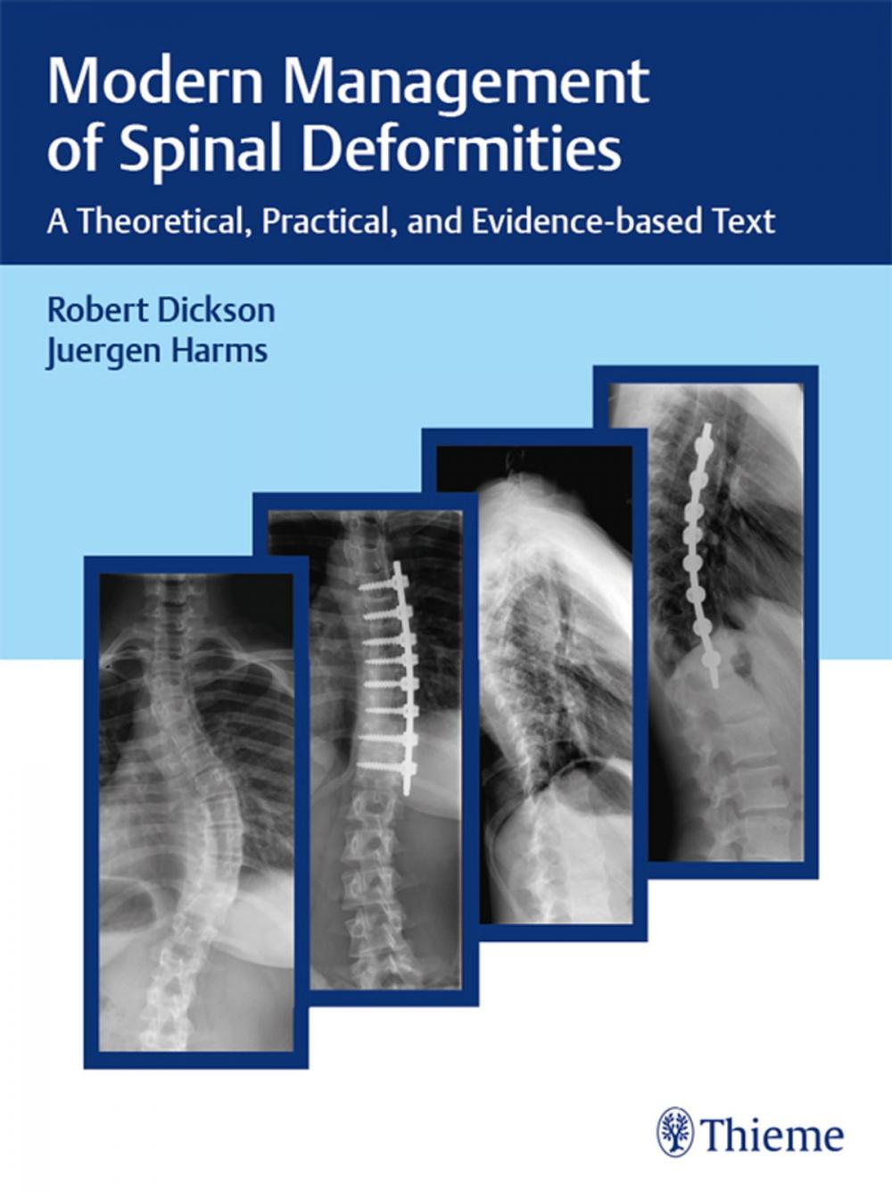 Big bigCover of Modern Management of Spinal Deformities