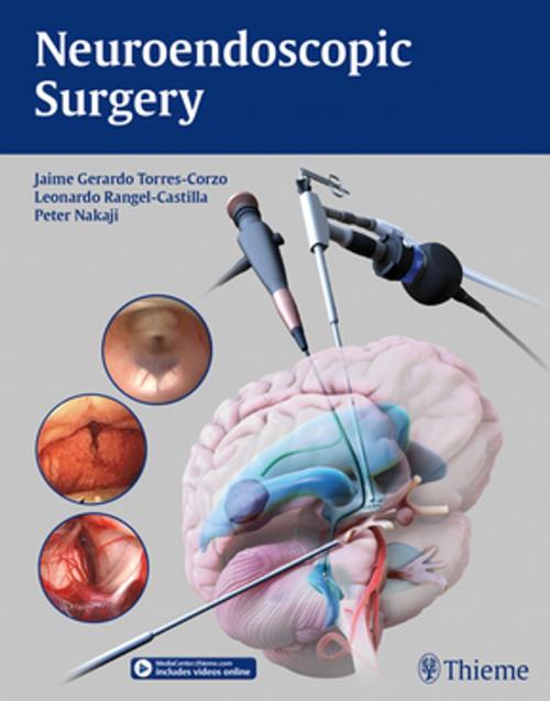 Cover of the book Neuroendoscopic Surgery by , Thieme