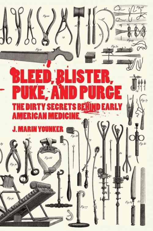Cover of the book Bleed, Blister, Puke, and Purge by J. Marin Younker, Lerner Publishing Group