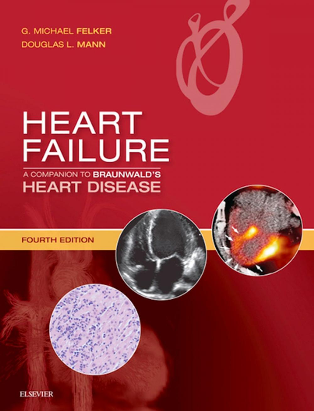 Big bigCover of Heart Failure: A Companion to Braunwald's Heart Disease E-Book