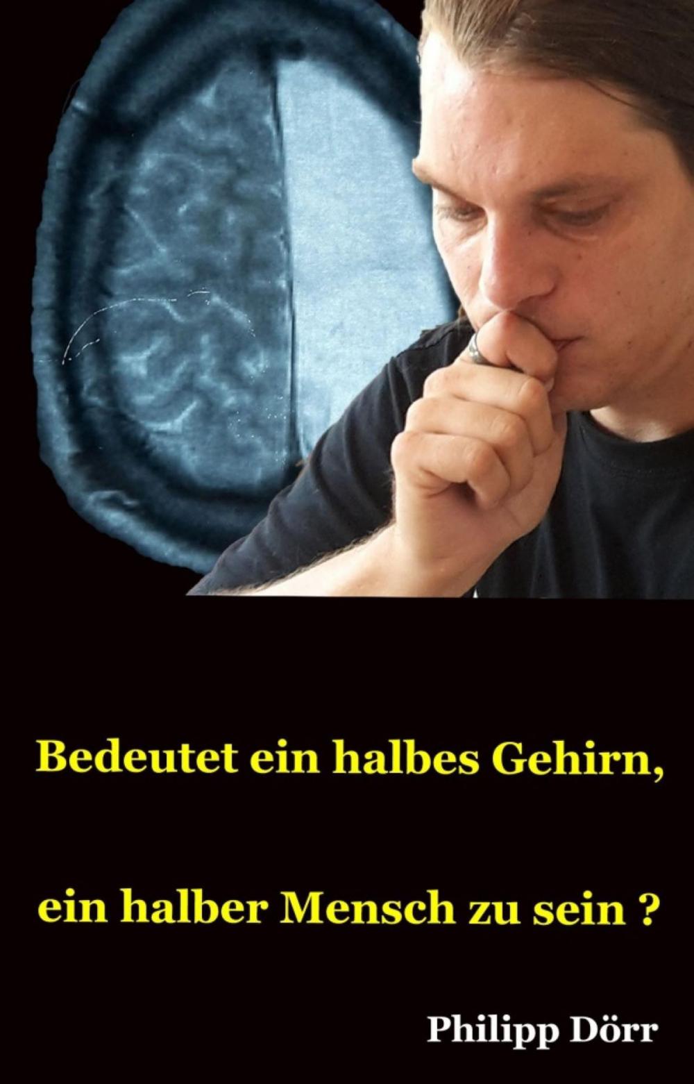 Big bigCover of Bedeutet ein halbes Gehirn, ein halber Mensch zu sein?