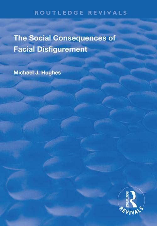 Cover of the book The Social Consequences of Facial Disfigurement by Michael J. Hughes, Taylor and Francis