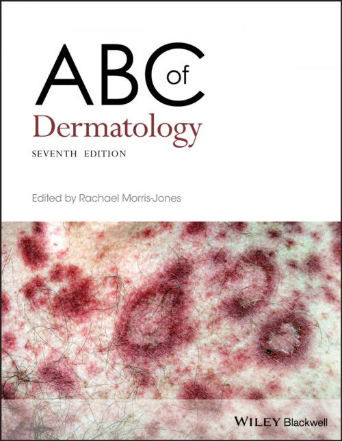 Cover of the book ABC of Dermatology by , Wiley