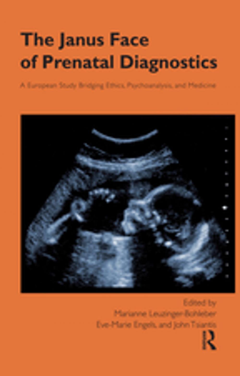 Big bigCover of The Janus Face of Prenatal Diagnostics